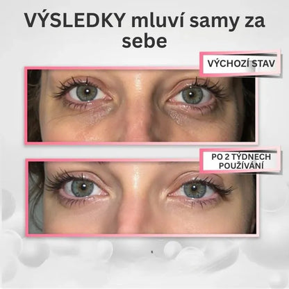 Anti-Falten LED-Augentherapie – YUMA RevitalEyes