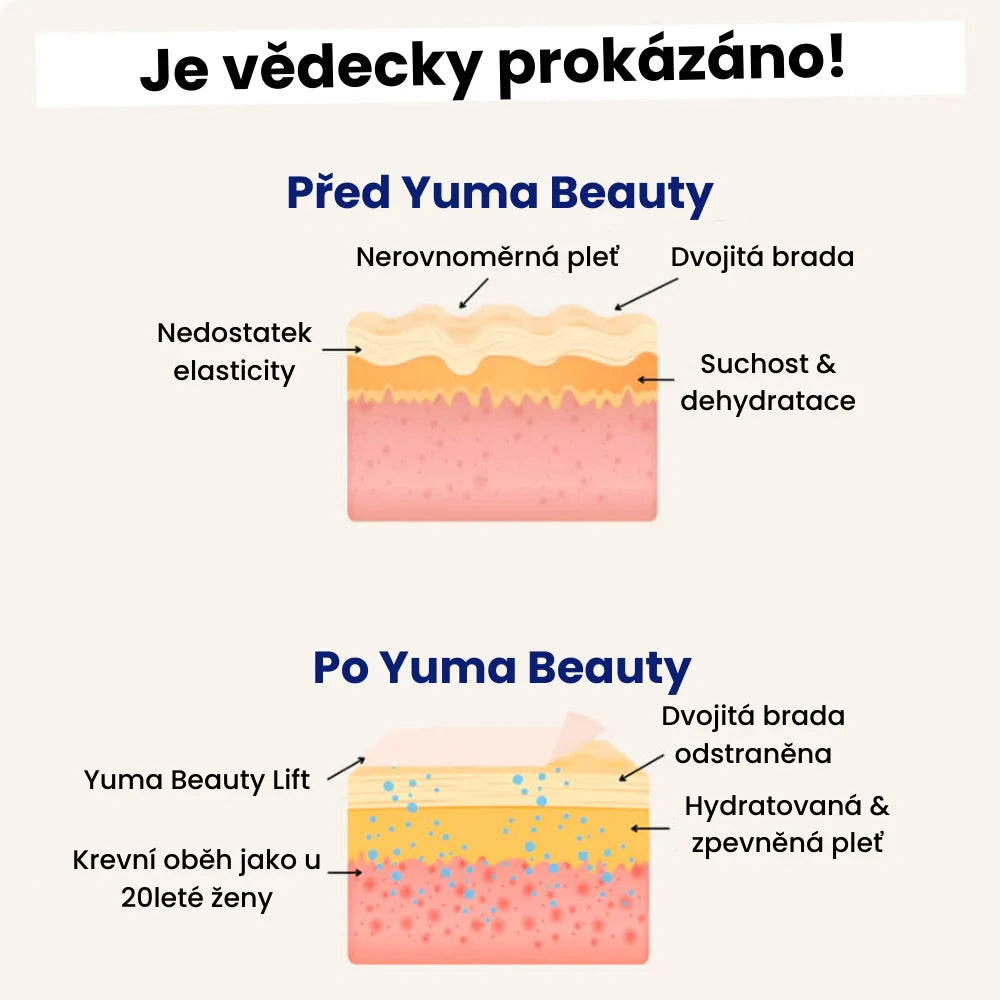 Yuma Beauty™ Lift: Verabschieden Sie sich noch heute von Ihrem Doppelkinn
