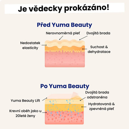 Yuma Beauty™ Lift: Verabschieden Sie sich noch heute von Ihrem Doppelkinn