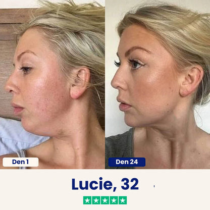 Yuma Beauty™ Lift: Verabschieden Sie sich noch heute von Ihrem Doppelkinn.
