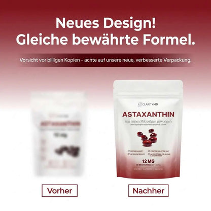 KlarsichtMD – Astaxanthin 12mg Weichkapseln – Natürlich für straffe, strahlende Haut, gesundes Haar & Energie